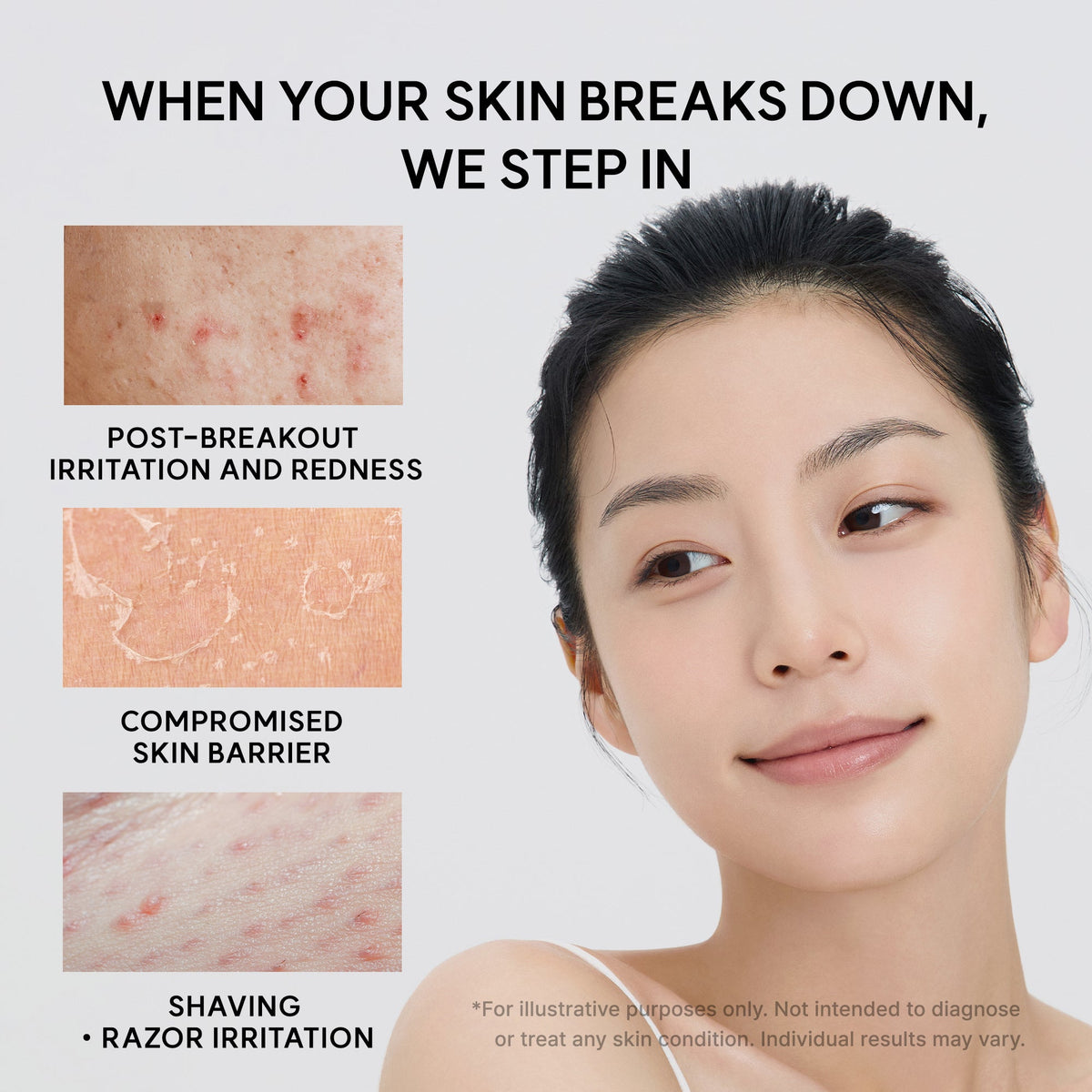Eraser Soothing Cream for Skin Barrier