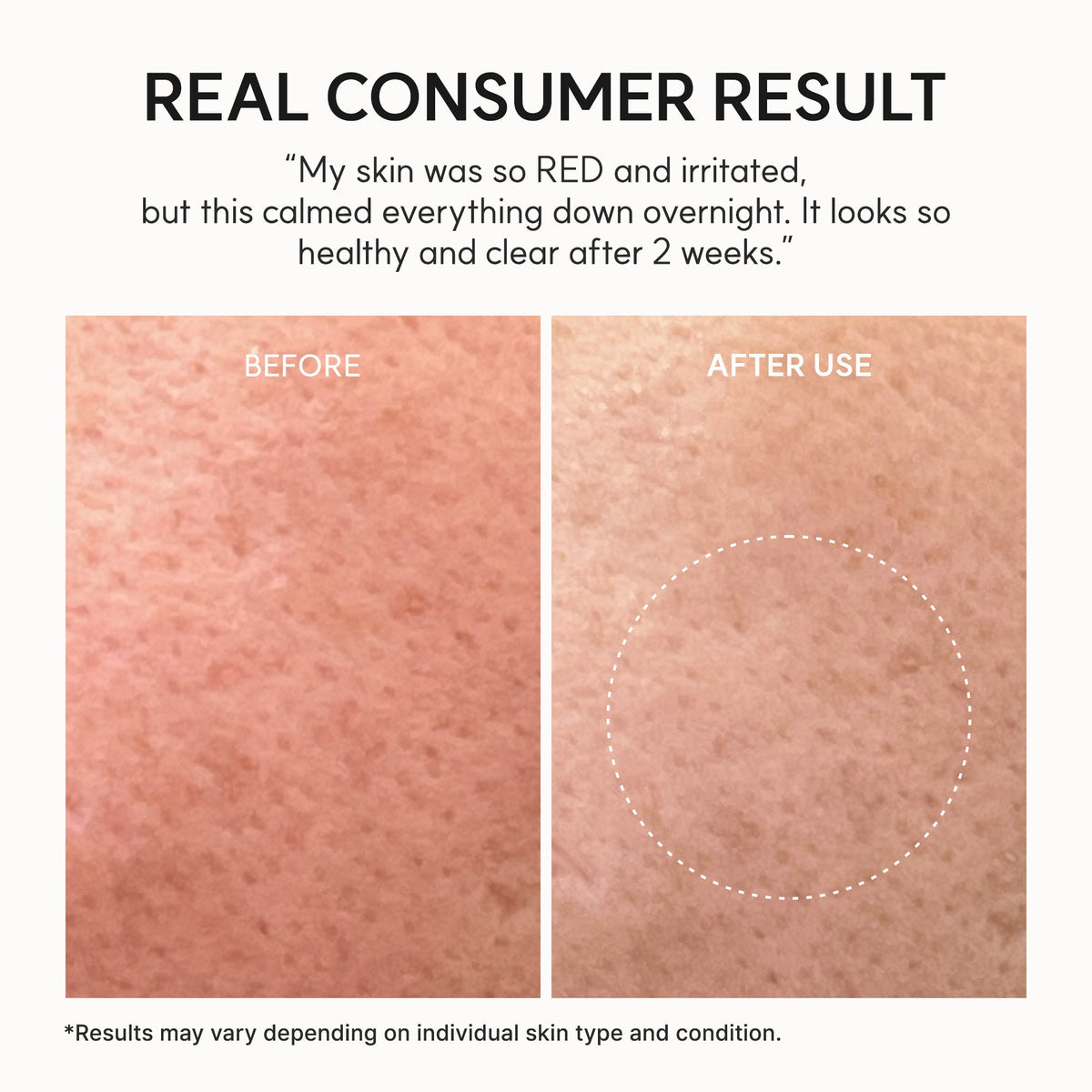 Eraser Soothing Cream for Skin Barrier