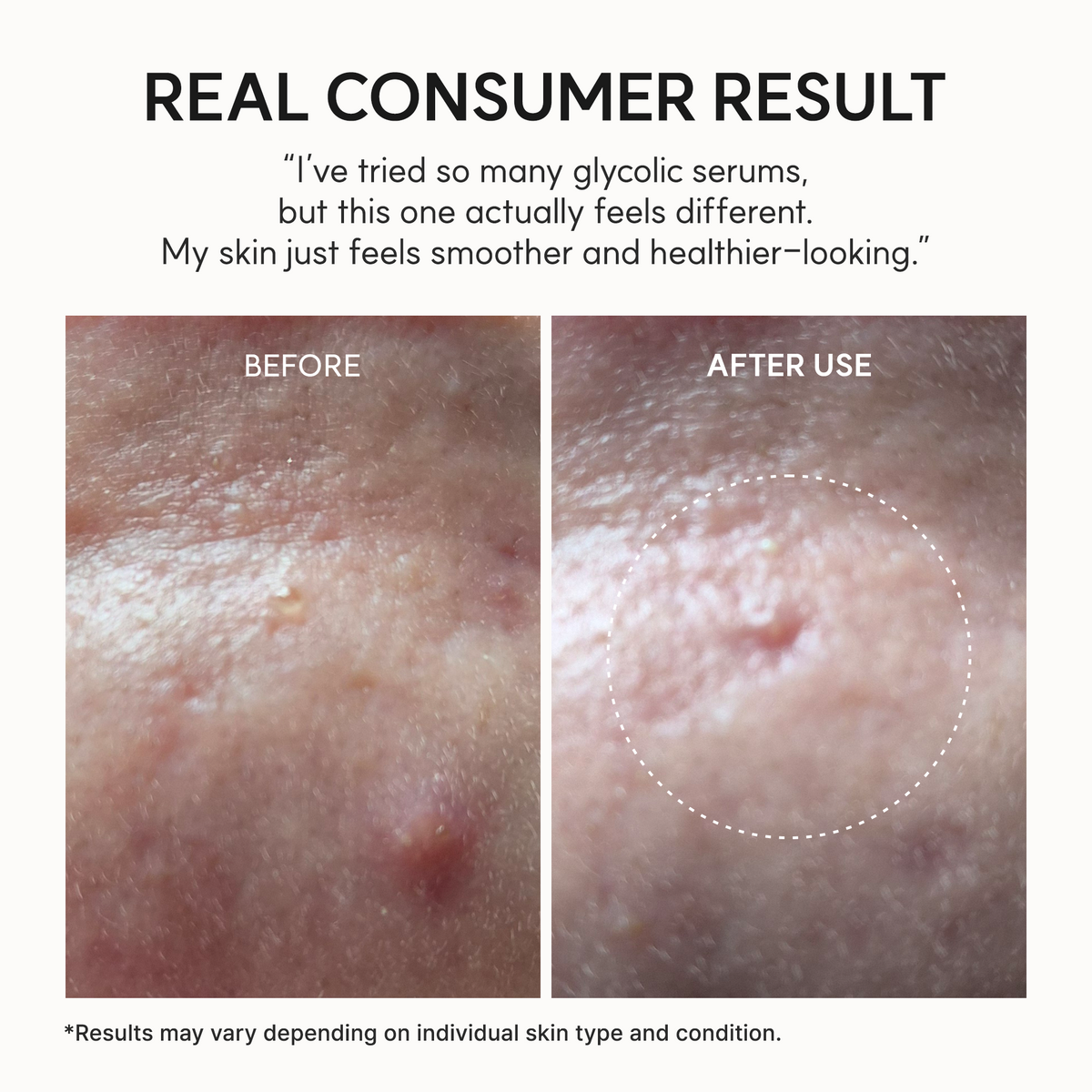 Spotless Glass Skin Duo