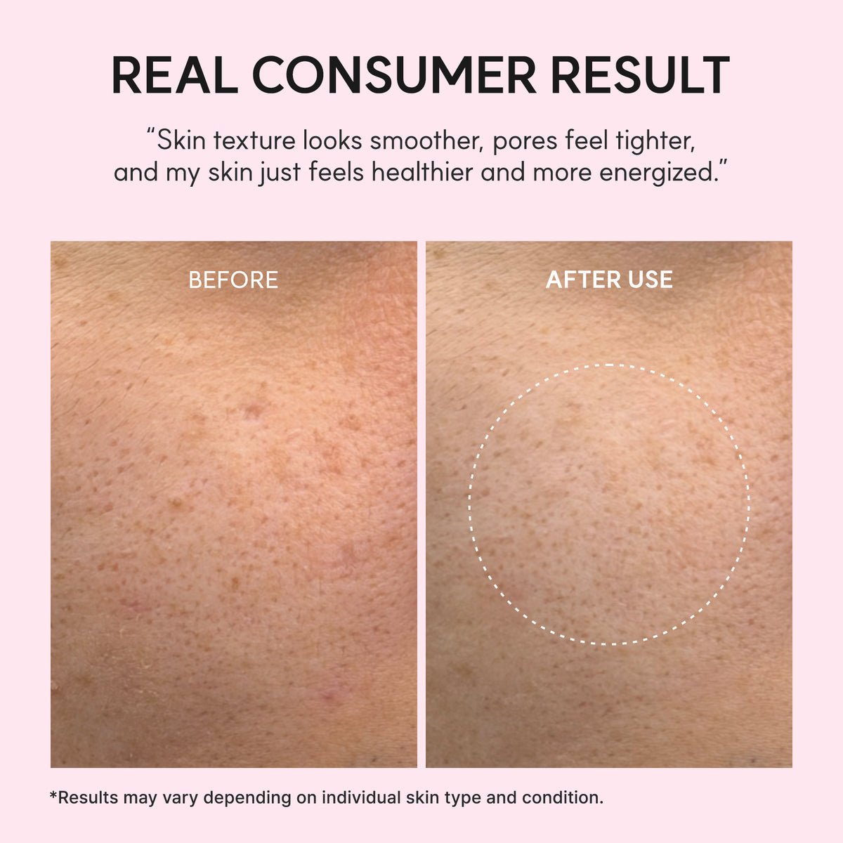 PDRN Booster Shot Serum