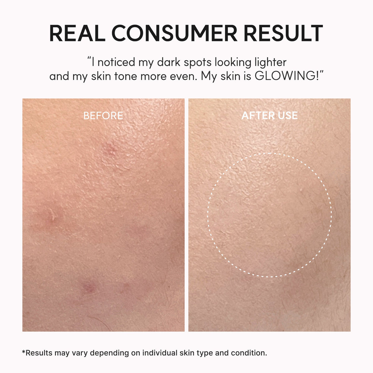 TXA Booster Shot Serum