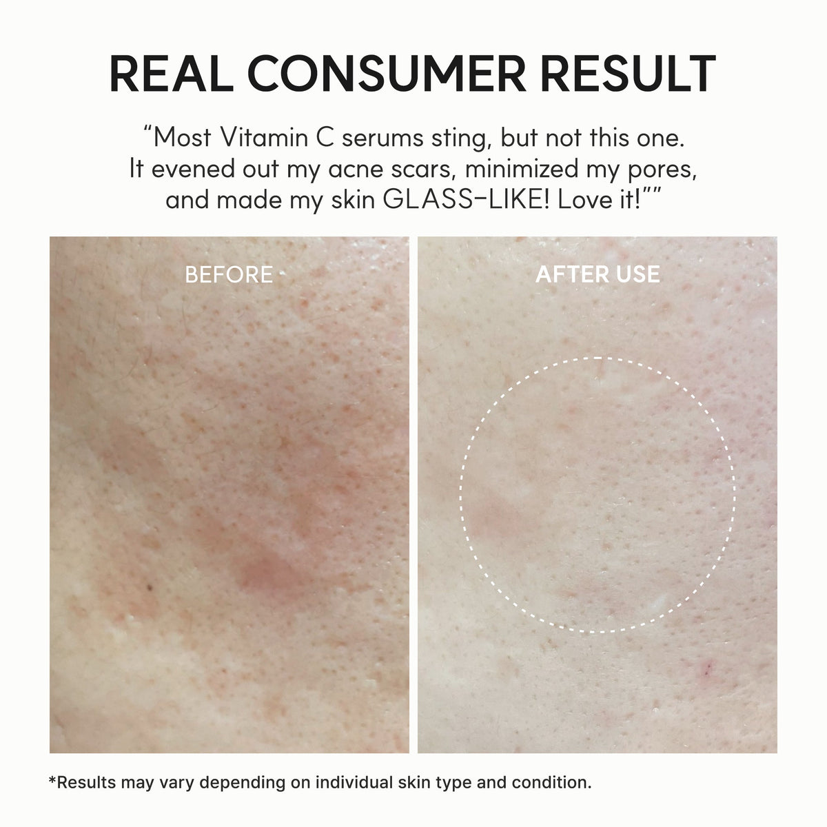 Vitamin C Booster Shot Serum