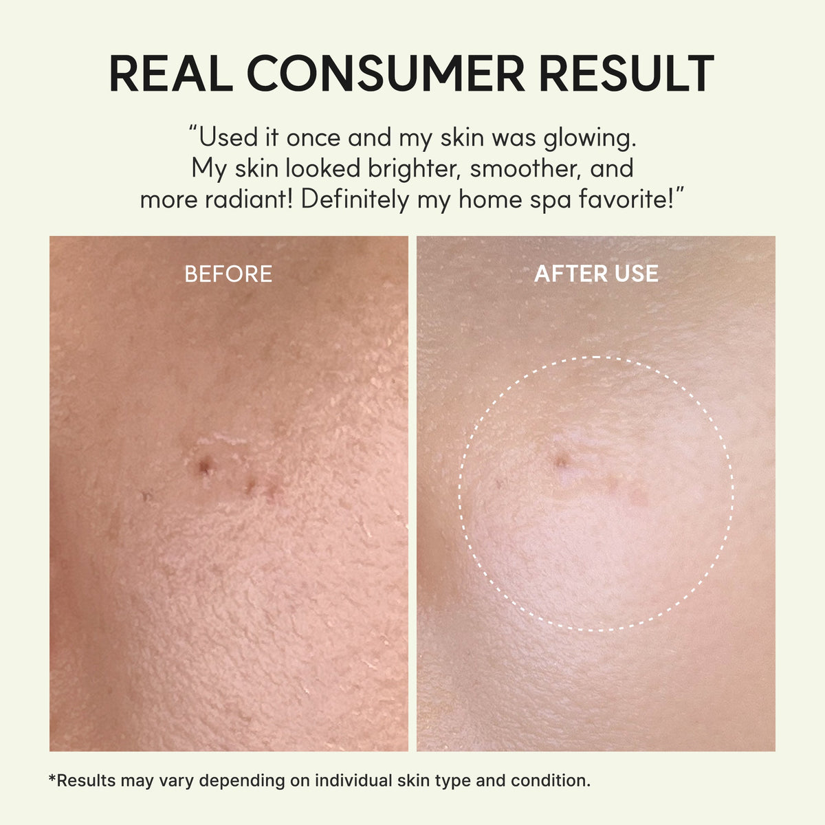 Vita Collagen Radiance Hydrogel Jello Mask
