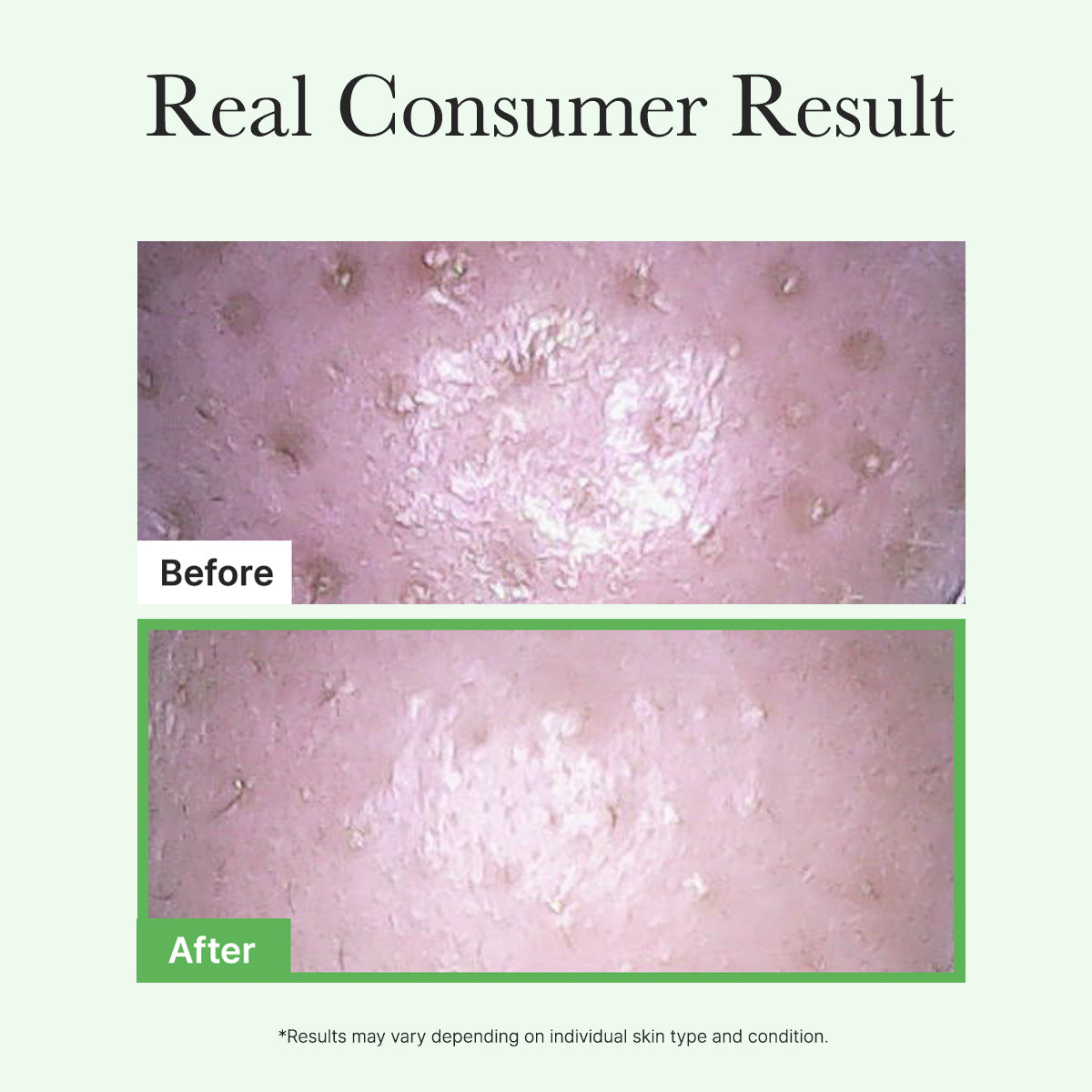 Pore Melt Mochi  Makeup-Removing Cleansing Oil